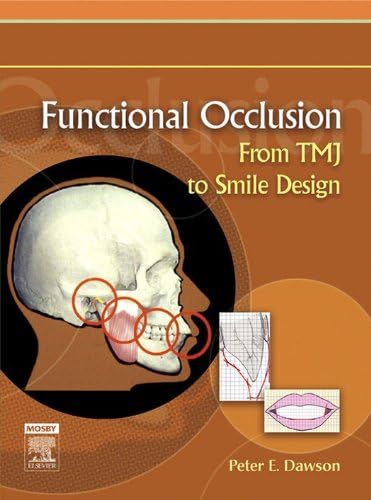 Amazon.com: Practical Procedures in Dental Occlusion eBook : Al